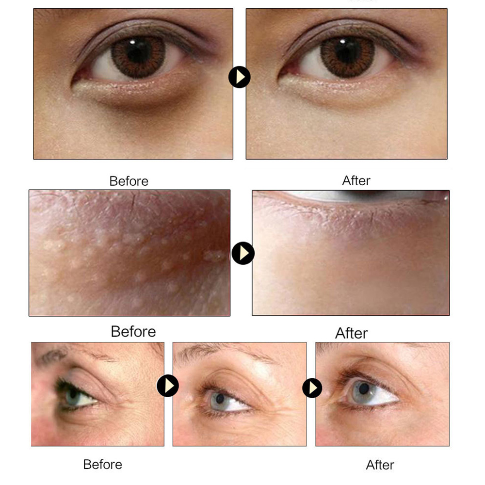 Collagen Eye Mask – Crystal Gold Anti-Aging Eye Patches
